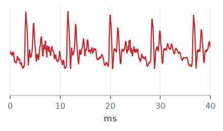 Waveform of /ɑ/: strong, fast-decaying ringing each period