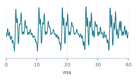 Waveform of /æ/